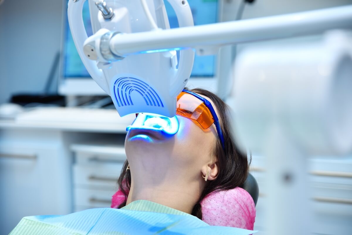 Bleaching-Teeth-Clinic Bleaching Teeth Clinic