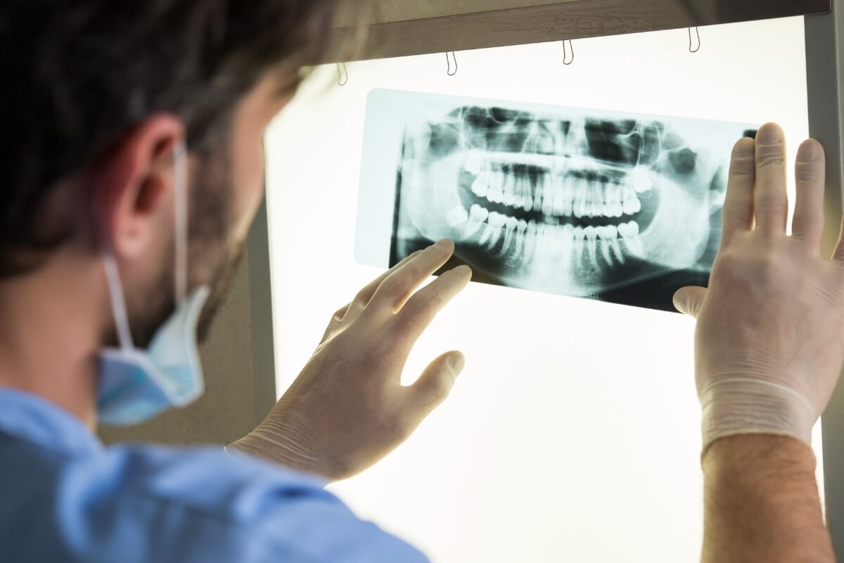 Dental-X-Ray Dental X-Ray