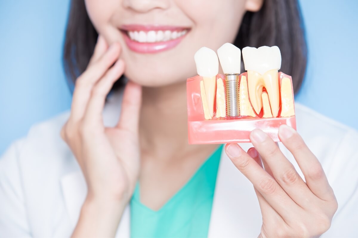 Dentist-Showing-Dental-Implant Dentist Showing Dental Implant